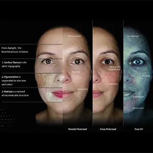 Skin Analysis