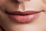 Lip fillers can enhance the cupid's bow