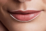 Lip fillers can restore the lip line