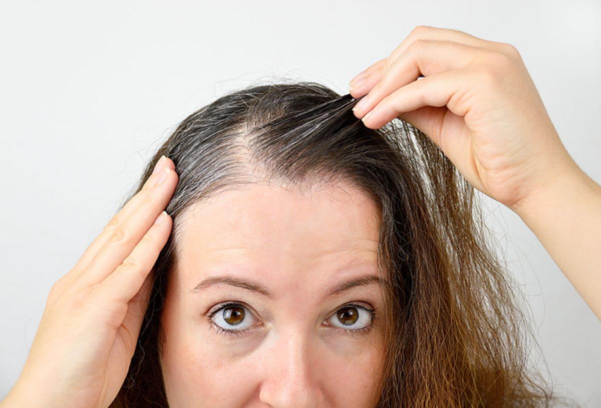 Can I Wash My Hair After PRP Treatment? - Face Med Store