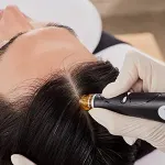 Hydrafacial Keravive treating scalp in female hair parting.