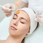 woman having a chemical peel