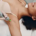 woman having laser hair removal for armpit