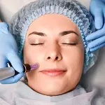 Microneedling pen on woman's face
