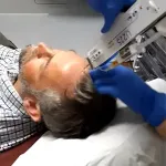 Man having PRP hair treatment using U225 injector