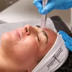 Microchannel facial with Twist